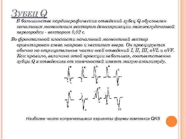 Патологический зубец q при инфаркте. Патологический зубец q в грудных отведениях. Патологический зубец q в отведении v1. Патологический зубец q в отведениях v1-v3. Зубец q в v2 v3.