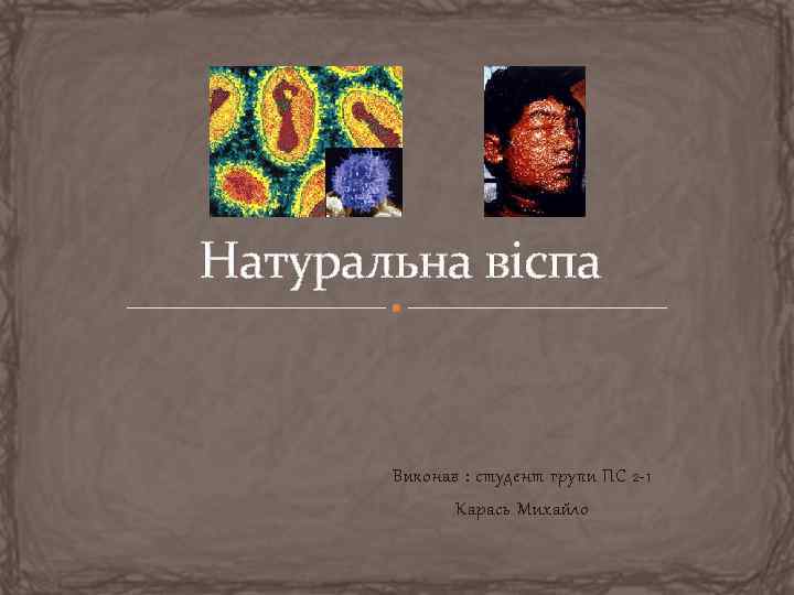 Натуральна віспа Виконав : студент групи ПС 2 -1 Карась Михайло 