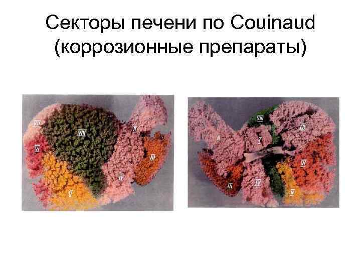 Секторы печени по Couinaud (коррозионные препараты) 