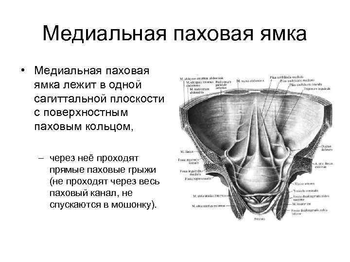 Медиальная паховая ямка • Медиальная паховая ямка лежит в одной сагиттальной плоскости с поверхностным