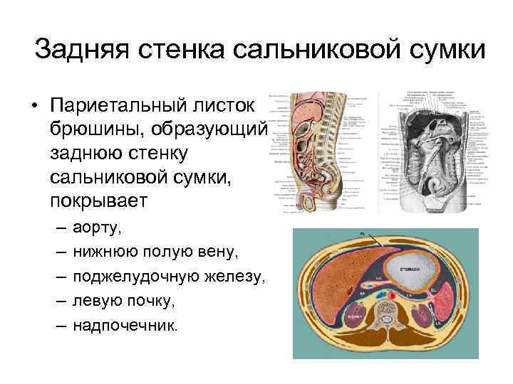 Задняя стенка сальниковой сумки • Париетальный листок брюшины, образующий заднюю стенку сальниковой сумки, покрывает
