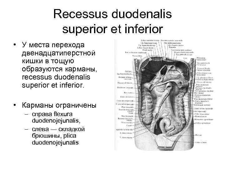 Recessus duodenalis superior et inferior • У места перехода двенадцатиперстной кишки в тощую образуются