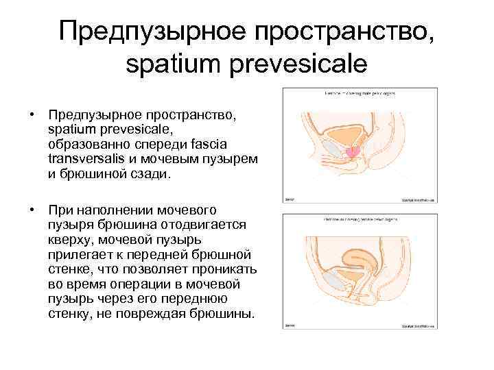 Предпузырное пространство, spatium prevesicale • Предпузырное пространство, spatium prevesicale, образованно спереди fascia transversalis и