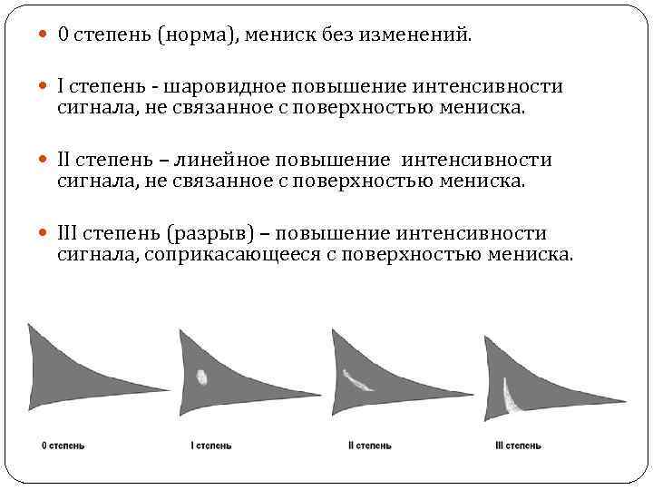 Повреждение внутреннего мениска 3 степени по stoller