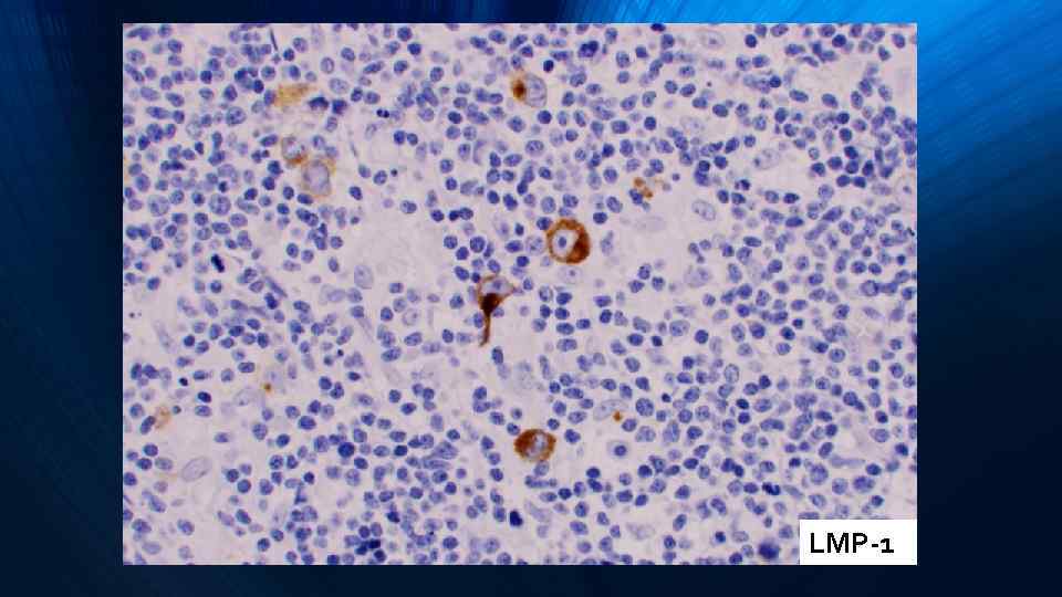 LMP-1 