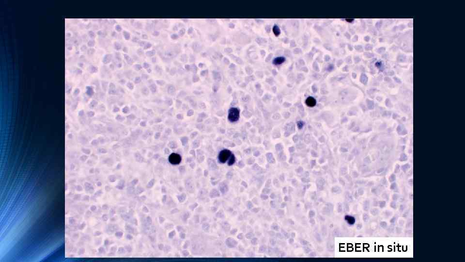 EBER in situ 