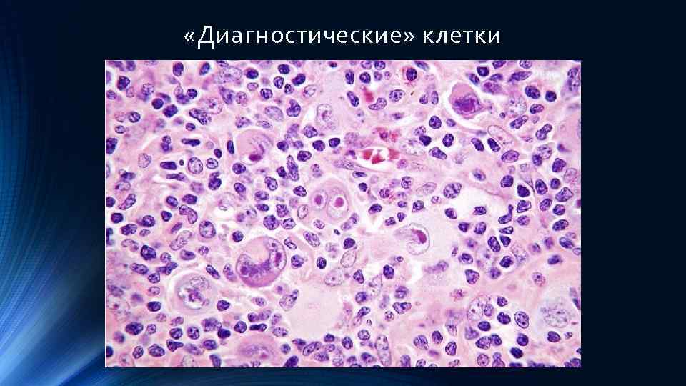  «Диагностические» клетки 