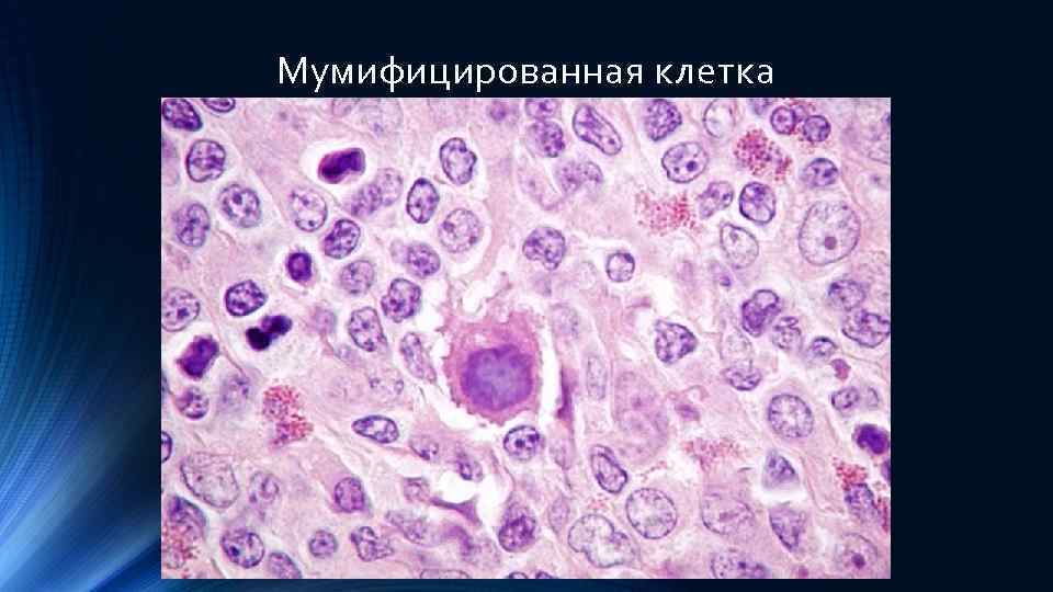 Мумифицированная клетка 