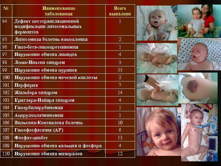 № Наименование заболевания Всего выявлено 94 Дефект посттрансляционной модификации лизосомальных ферментов 1 95 Лизосомная