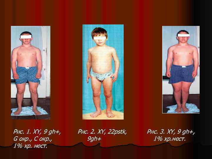 Рис. 1. XY, 9 gh+, G окр. , С окр. , 1% хр. нест.