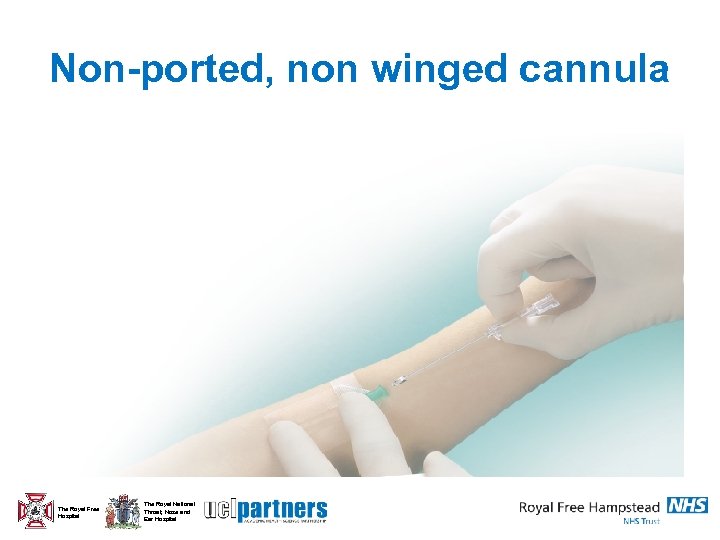 Non-ported, non winged cannula The Royal Free Hospital The Royal National Throat, Nose and