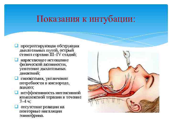 Показания к интубации: q прогрессирующая обструкция дыхательных путей, острый стеноз гортани III–IV стадий; q