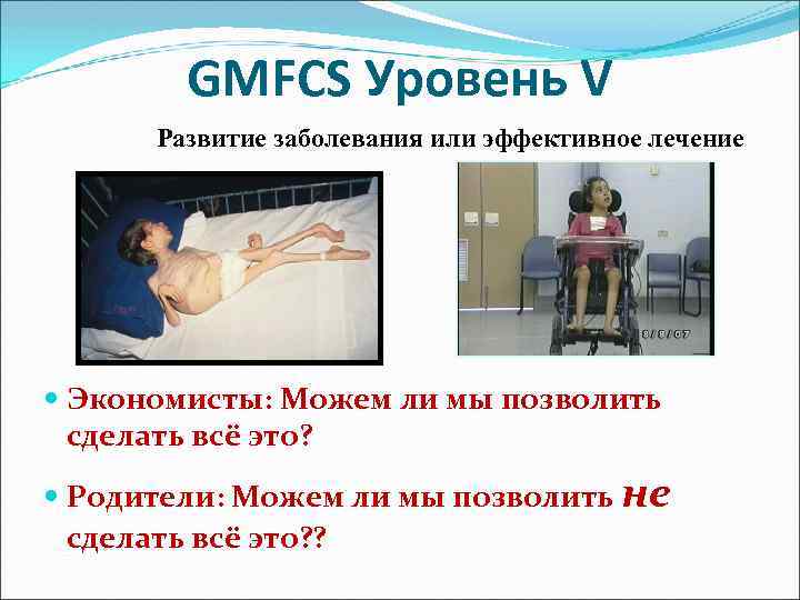 Уровни дцп. Уровни GMFCS ДЦП. GMFCS 2 уровень при ДЦП. Шкала GMFCS уровни двигательных нарушений. GMFCS 1 уровень при ДЦП.