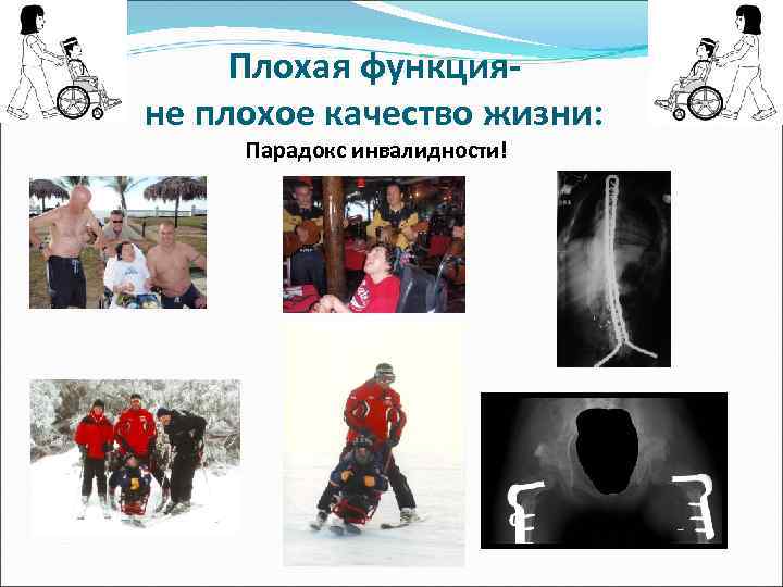 Плохая функцияне плохое качество жизни: Парадокс инвалидности! 