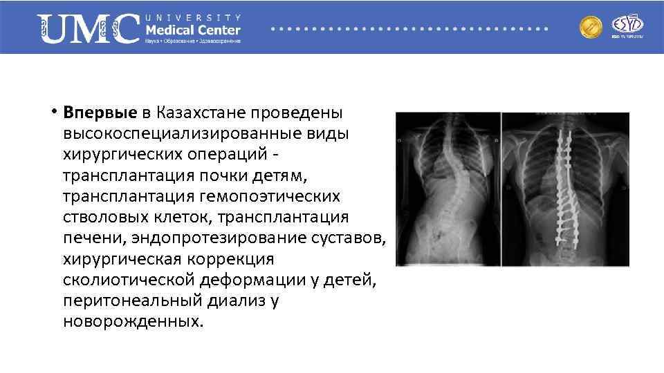  • Впервые в Казахстане проведены высокоспециализированные виды хирургических операций - трансплантация почки детям,