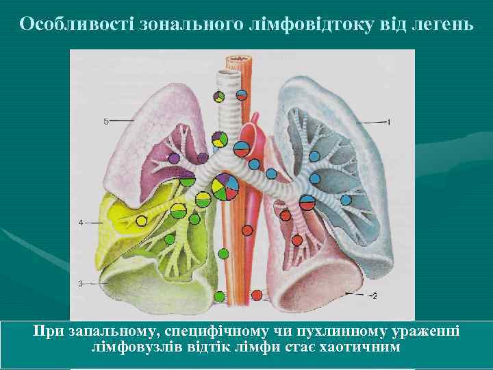 Особливості зонального лімфовідтоку від легень При запальному, специфічному чи пухлинному ураженні лімфовузлів відтік лімфи