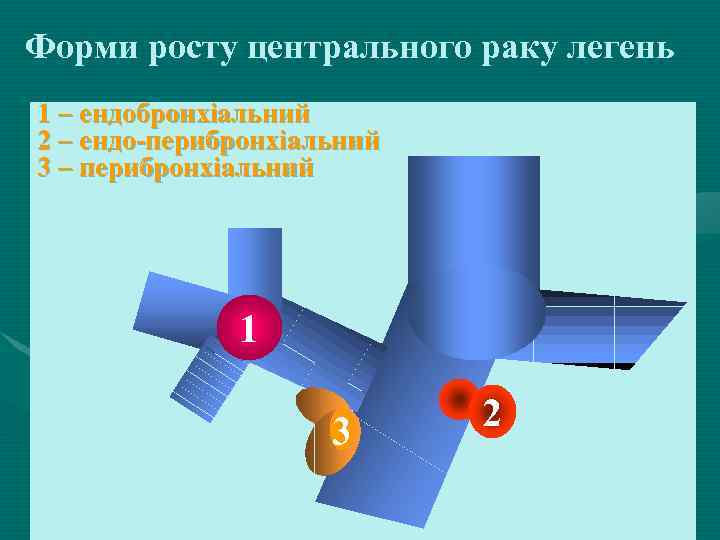 Форми росту центрального раку легень 1 – ендобронхіальний 2 – ендо-перибронхіальний 3 – перибронхіальний