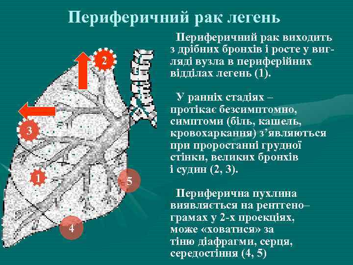 Периферичний рак легень Периферичний рак виходить з дрібних бронхів і росте у вигляді вузла