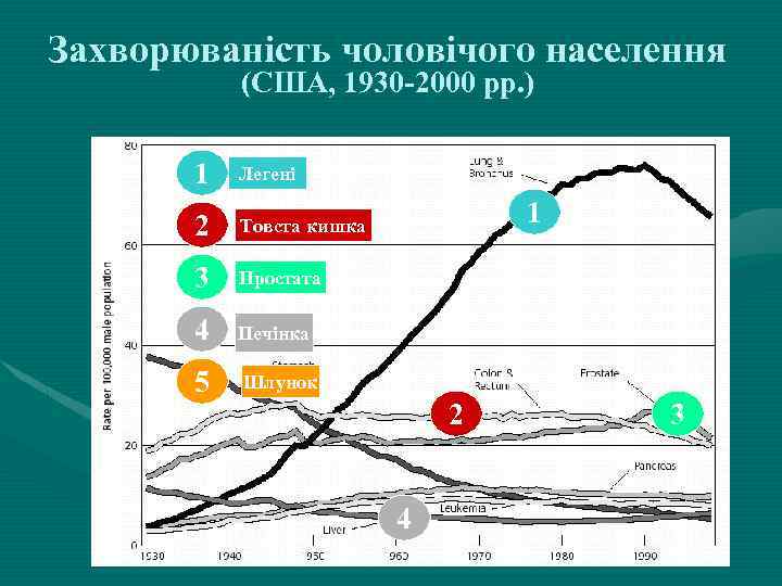 Захворюваність чоловічого населення (США, 1930 -2000 рр. ) 1 Легені 2 Товста кишка 3