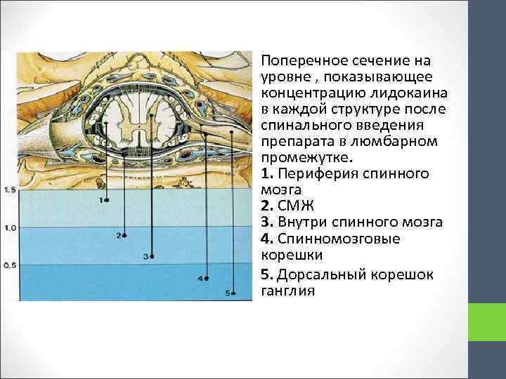  Поперечное сечение на уровне , показывающее концентрацию лидокаина в каждой структуре после спинального