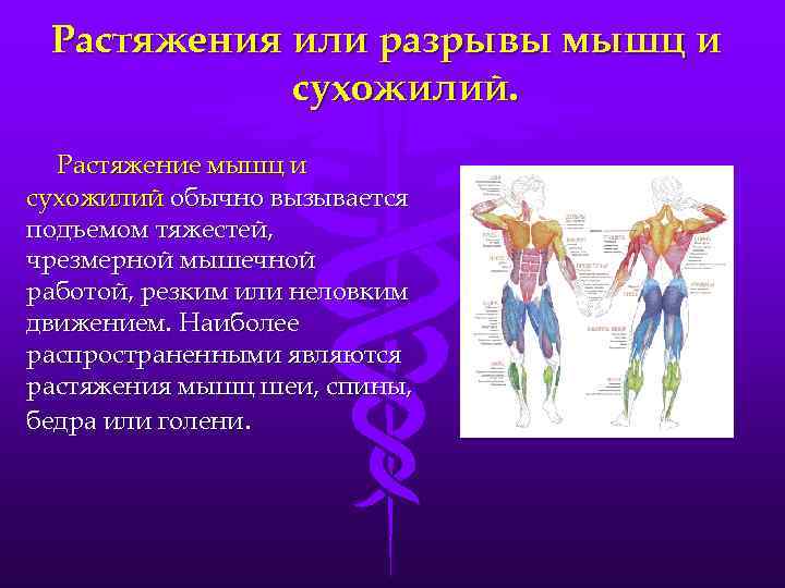 Растяжения или разрывы мышц и сухожилий. Растяжение мышц и сухожилий обычно вызывается подъемом тяжестей,