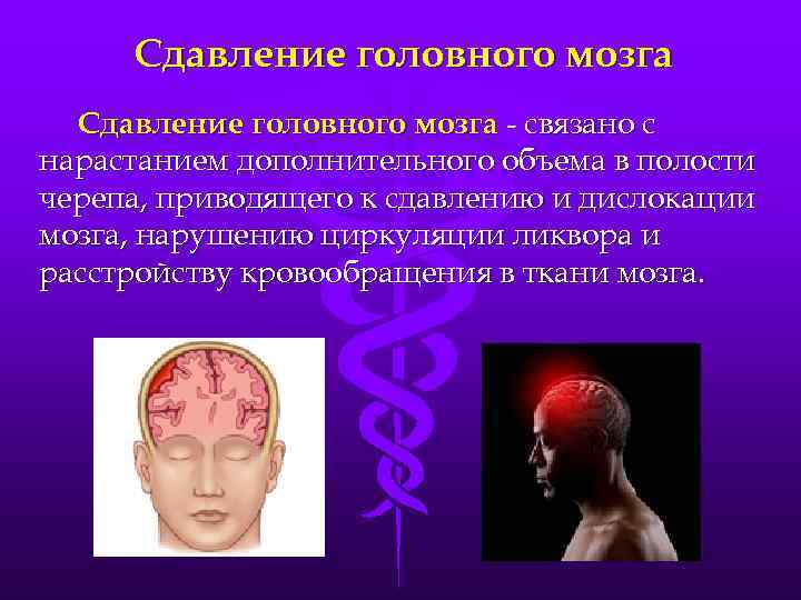 Сдавление головного мозга - связано с нарастанием дополнительного объема в полости черепа, приводящего к