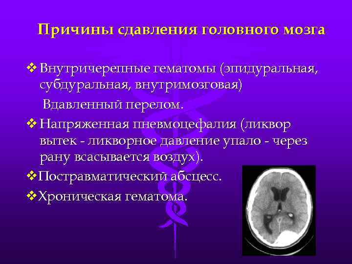 Причины сдавления головного мозга v Внутричерепные гематомы (эпидуральная, субдуральная, внутримозговая) Вдавленный перелом. v Напряженная
