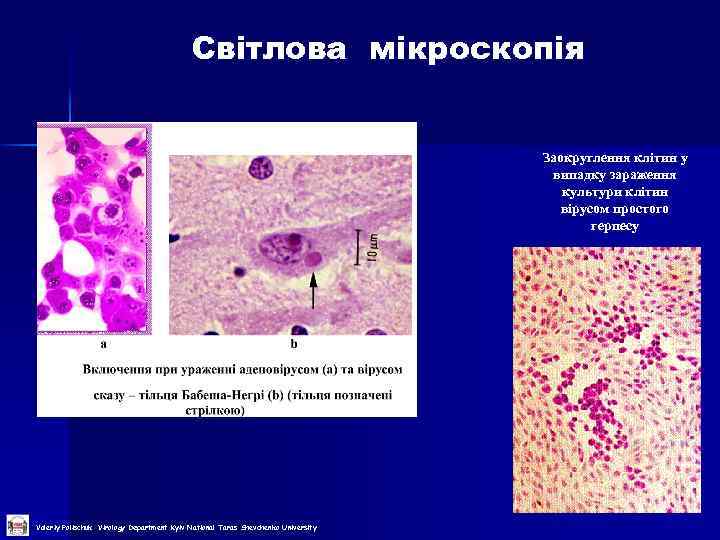 Світлова мікроскопія Заокруглення клітин у випадку зараження культури клітин вірусом простого герпесу Valeriy Polischuk