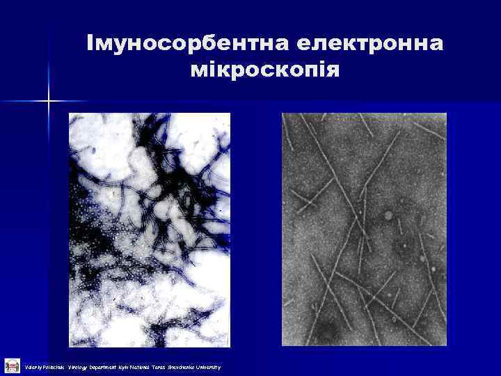 Імуносорбентна електронна мікроскопія Valeriy Polischuk Virology Department Kyiv National Taras Shevchenko University 