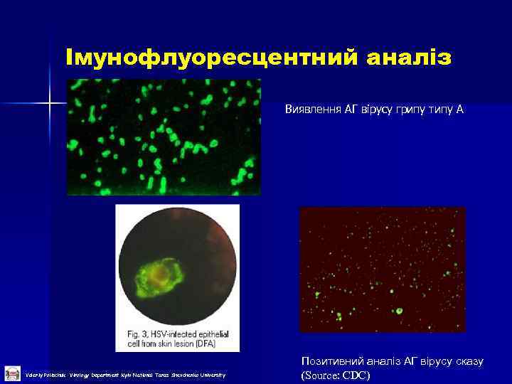 Імунофлуоресцентний аналіз Виявлення АГ вірусу грипу типу А Valeriy Polischuk Virology Department Kyiv National
