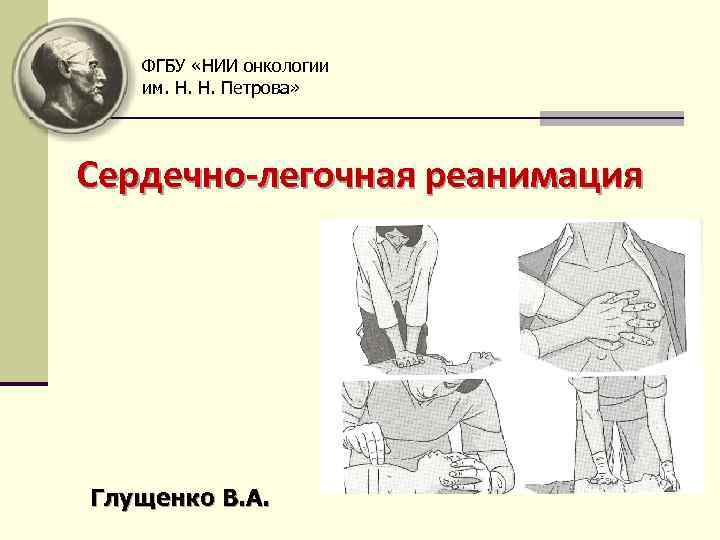 ФГБУ «НИИ онкологии им. Н. Н. Петрова» Сердечно-легочная реанимация Глущенко В. А. 