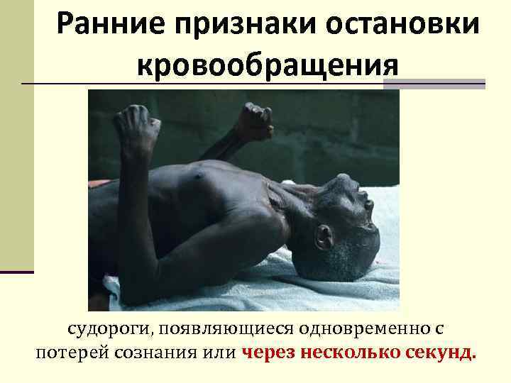 Ранние признаки остановки кровообращения судороги, появляющиеся одновременно с потерей сознания или через несколько секунд.