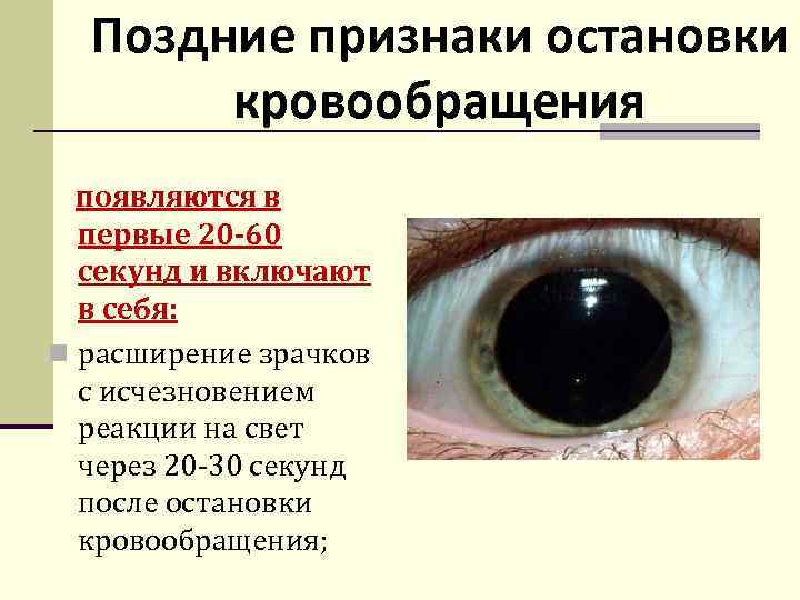 Поздние признаки остановки кровообращения появляются в первые 20 -60 секунд и включают в себя: