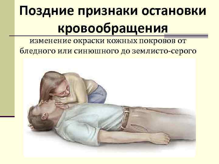 Поздние признаки остановки кровообращения изменение окраски кожных покровов от бледного или синюшного до землисто-серого
