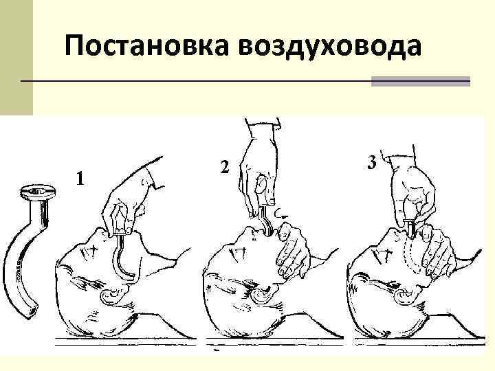 Постановка воздуховода 