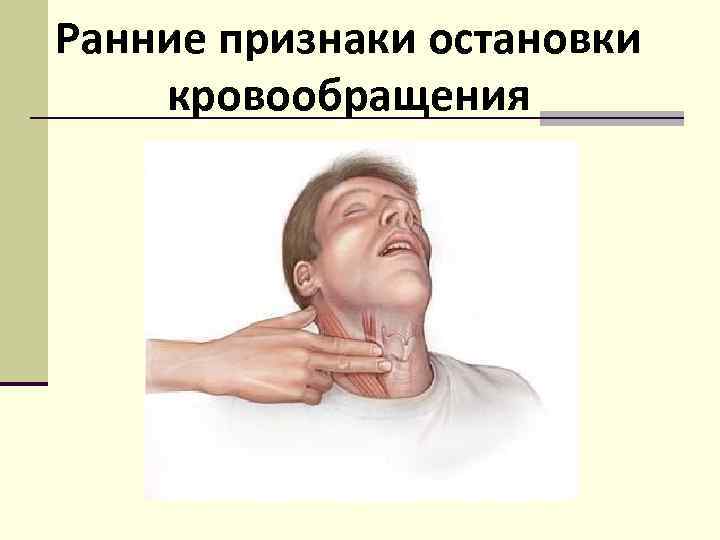 Ранние признаки остановки кровообращения Исчезновение пульса на сонной артерии 