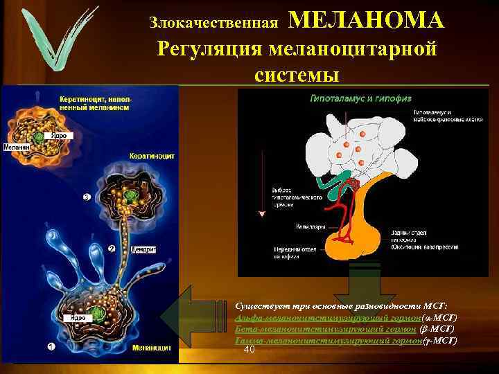 Злокачественная МЕЛАНОМА Регуляция меланоцитарной системы Существует три основные разновидности МСГ: Альфа-меланоцитстимулирующий гормон(α-МСГ) Бета-меланоцитстимулирующий гормон