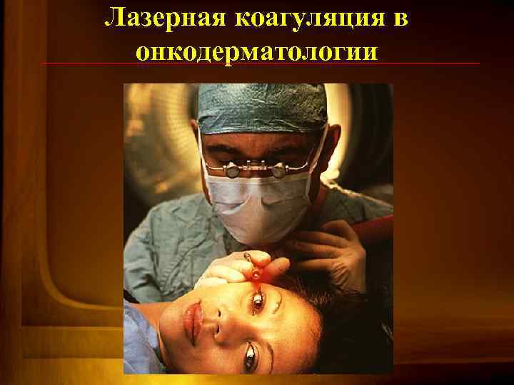 Лазерная коагуляция в онкодерматологии 