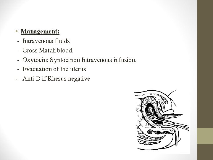  • Management: - Intravenous fluids - Cross Match blood. - Oxytocin; Syntocinon Intravenous