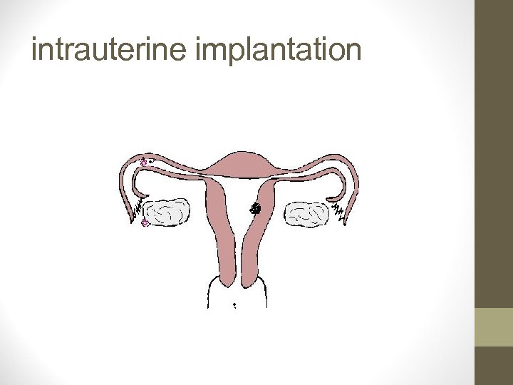 intrauterine implantation 