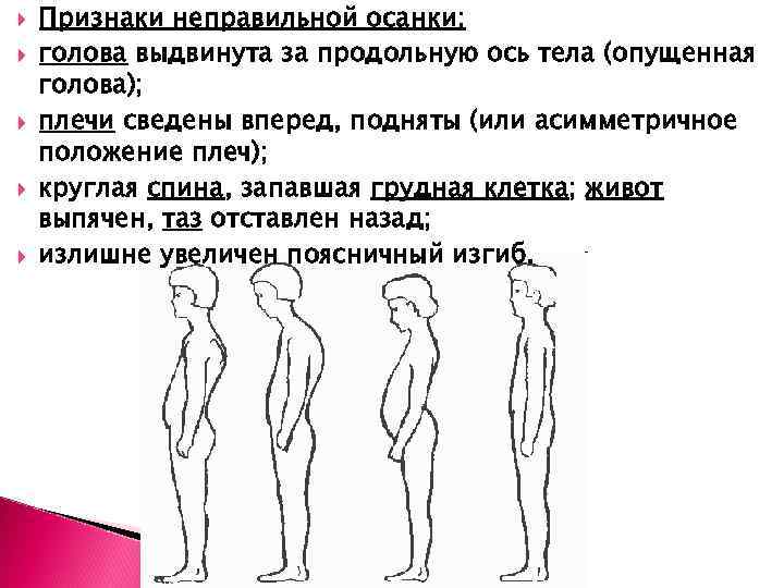 Круглая спина в год. Признаки неправильной осанки. Голова выдвинута вперед. Асимметричное положение тела. Голова выдвинутая вперед осанка.