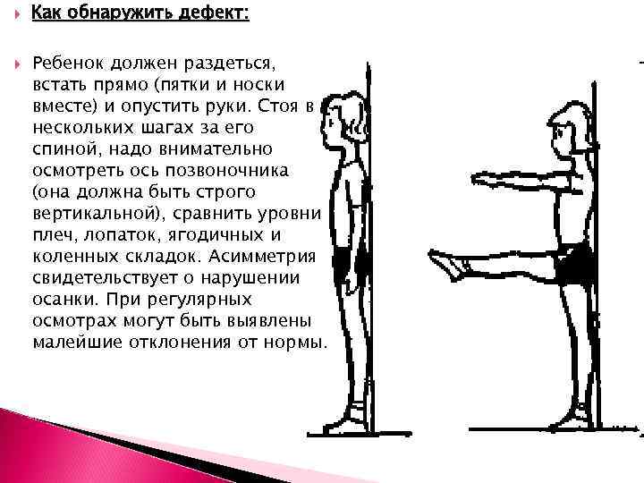  Как обнаружить дефект: Ребенок должен раздеться, встать прямо (пятки и носки вместе) и