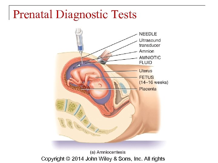 Prenatal Diagnostic Tests Copyright © 2014 John Wiley & Sons, Inc. All rights 