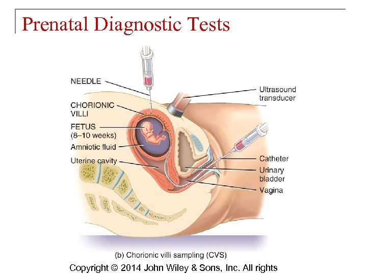 Prenatal Diagnostic Tests Copyright © 2014 John Wiley & Sons, Inc. All rights 