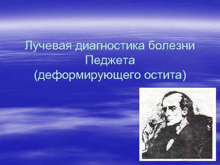 Лучевая диагностика болезни Педжета (деформирующего остита) 