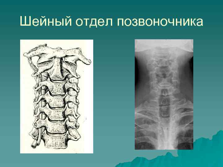 Шейный отдел позвоночника 