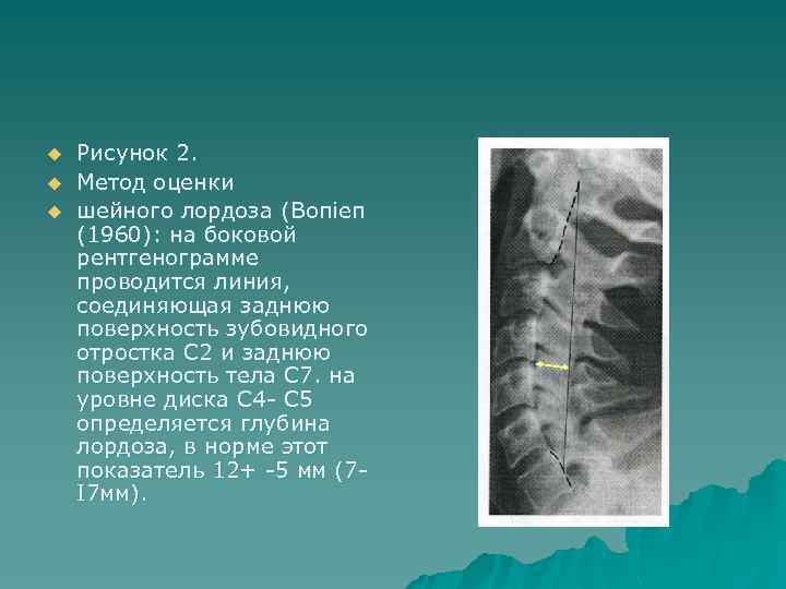 Рентгены анатомия