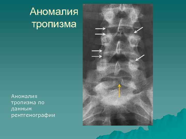 Рентгены анатомия