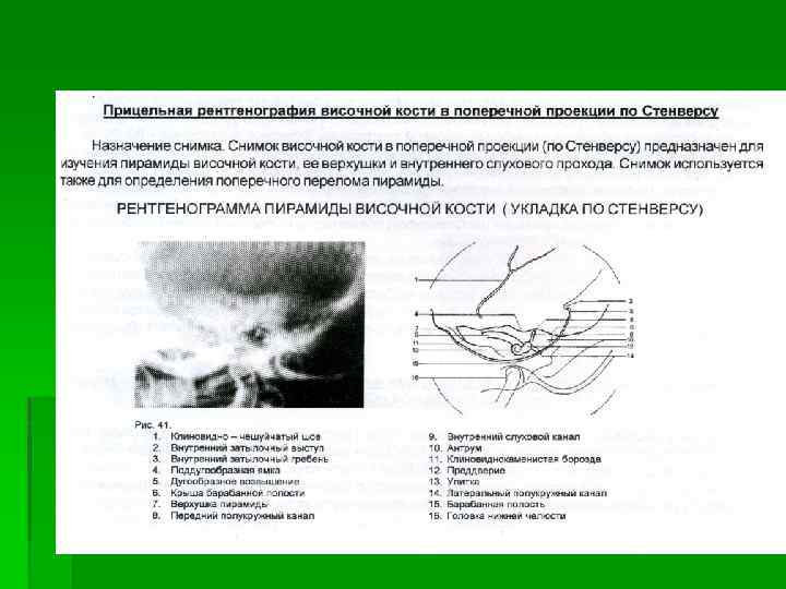 Рентгенография височных костей