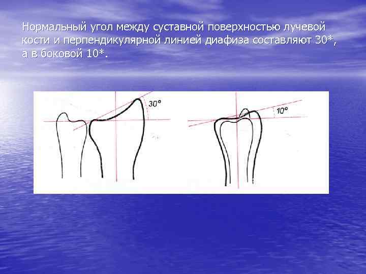 Схема длинной трубчатой кости взрослого и ребенка рентген